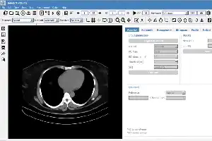 Innovación de software médico indonesio supera a la tecnología de EE. UU. y Francia
