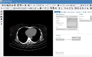 Innovación de software médico indonesio supera a la tecnología de EE. UU. y Francia