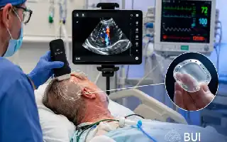 Innovación en la Interfaz de Ultrasonido Cerebral: Transformando los Implantes Craneales en Lentes Diagnósticas en Tiempo Real
