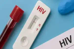 Noticias virales sobre cientos de niños expuestos al VIH en Sidoarjo: experta de Umsura enfatiza la importancia de la detección temprana sin estigma