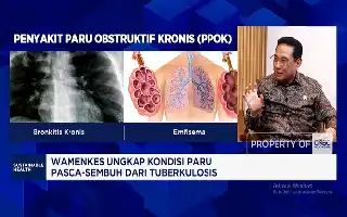 El Ministerio de Salud amplía la escala de detección temprana de la tuberculosis para reducir la carga económica nacional