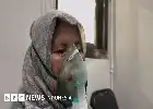 Ancaman Penyakit Asbestosis: Nestapa Pekerja Pabrik dan Urgensi Larangan Penggunaan Asbes di Indonesia